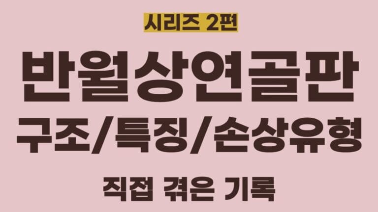 반월상연골판시리즈2편의 썸네일이미지입니다. 구조, 특징, 손상유형에 대해 정리한 글입니다.