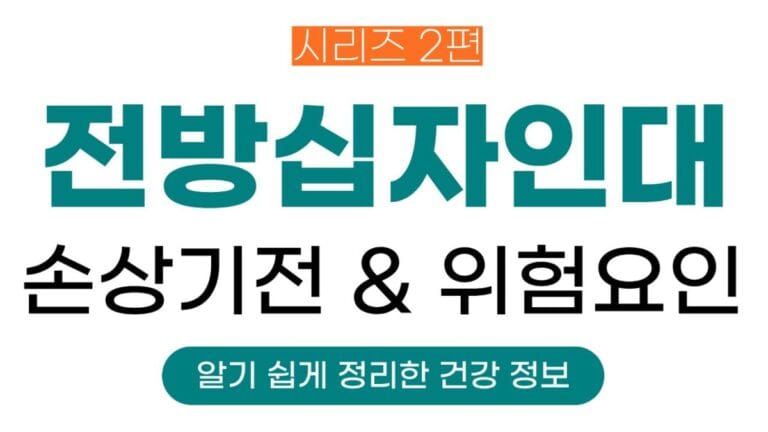전방십자인대시리즈 2편의 썸네일이미지입니다. 전방십자인대 손상기전과 위험요인에 대해 정리한 글입니다.